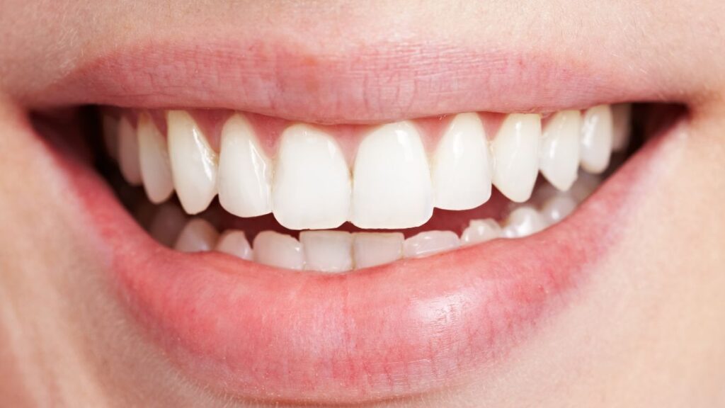 Bright white smile showing results of baking soda teeth whitening.
